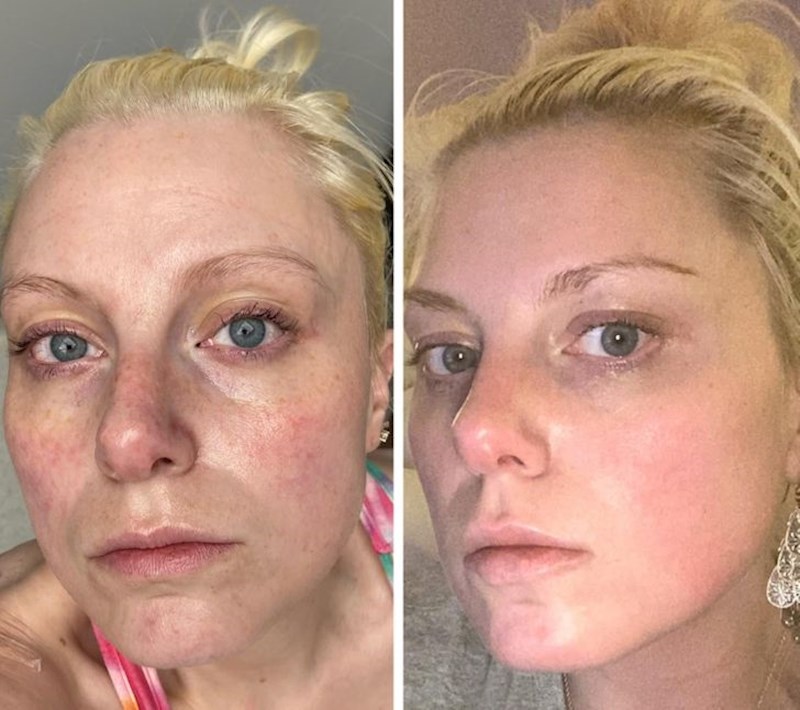 16. "Odlučila sam podijeliti ove usporedne fotografije kako bi svi oni koji žele napraviti promjenu, a boje se ili su nesigurni u vezi promjene vidjeli razliku. Možda vam pomogne u odluci"