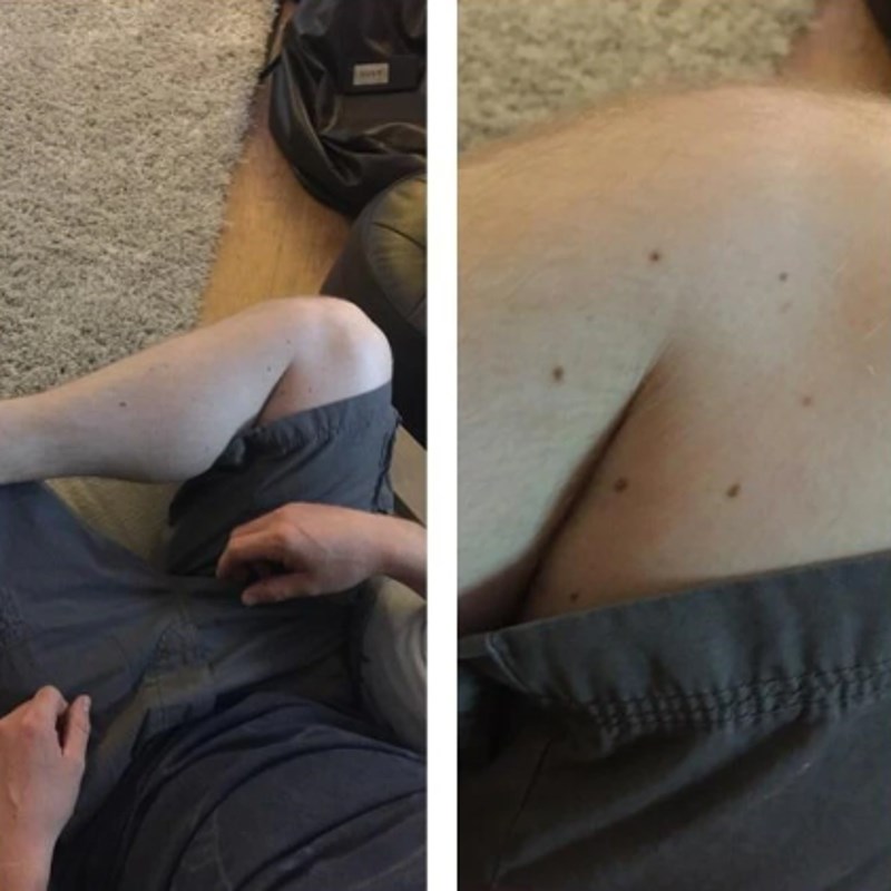 10. "Madeži na mojoj nozi čine savršeni krug."