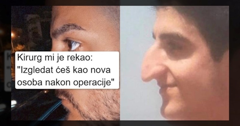 14 ljudi kojima je estetski zahvat potpuno promijenio izgled i život