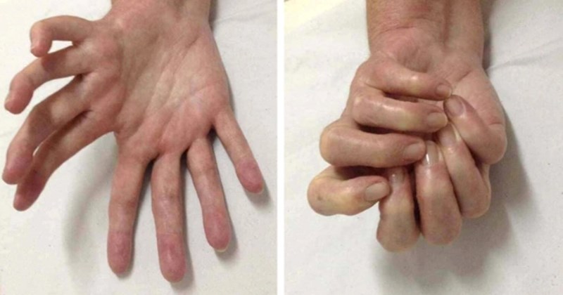 10+ jedinstvenih ljudi čije se neobične i posebne fizičke karakteristike ne viđaju svaki dan