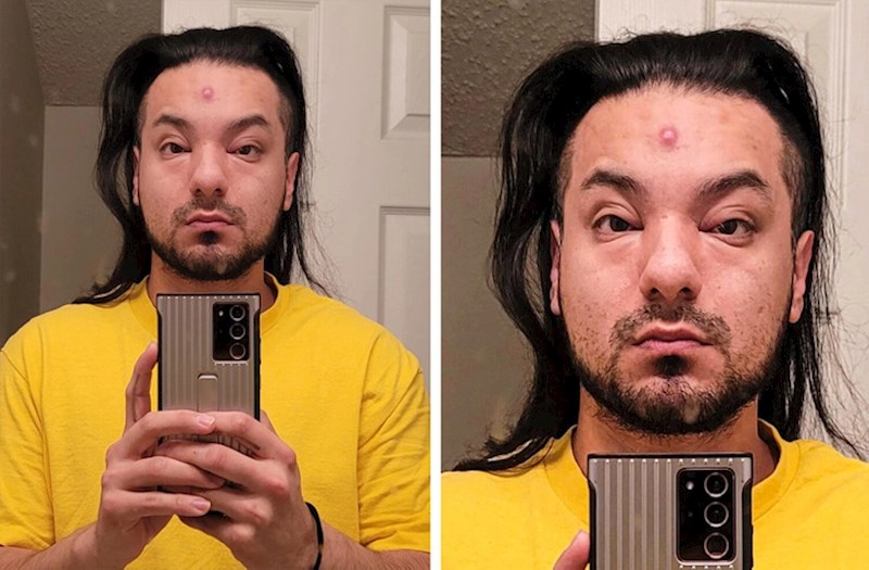 2. "Imao sam ogromnu bubuljicu koja je poprilično natekla i sad izgledam kao lik iz nekog crtića"