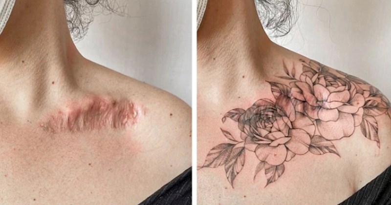 Ovi hrabri ljudi odlučili su svoje ožiljke pretvoriti u predivne tetovaže, izdvojili smo 15 fotki