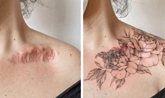 Ovi hrabri ljudi odlučili su svoje ožiljke pretvoriti u predivne tetovaže, izdvojili smo 15 fotki