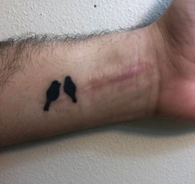 "Moj ožiljak mi je bio motivacija za ovu tetovažu."