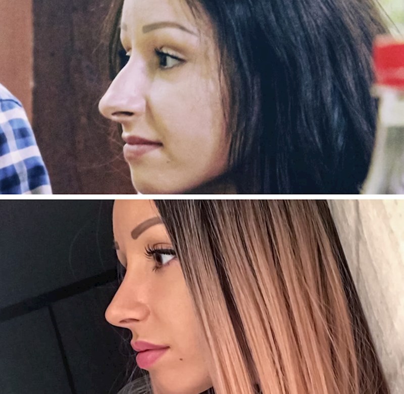 5. Napisala je da operacija nosa i nošenje aparatića za zube mogu učiniti čuda sa samopouzdanjem