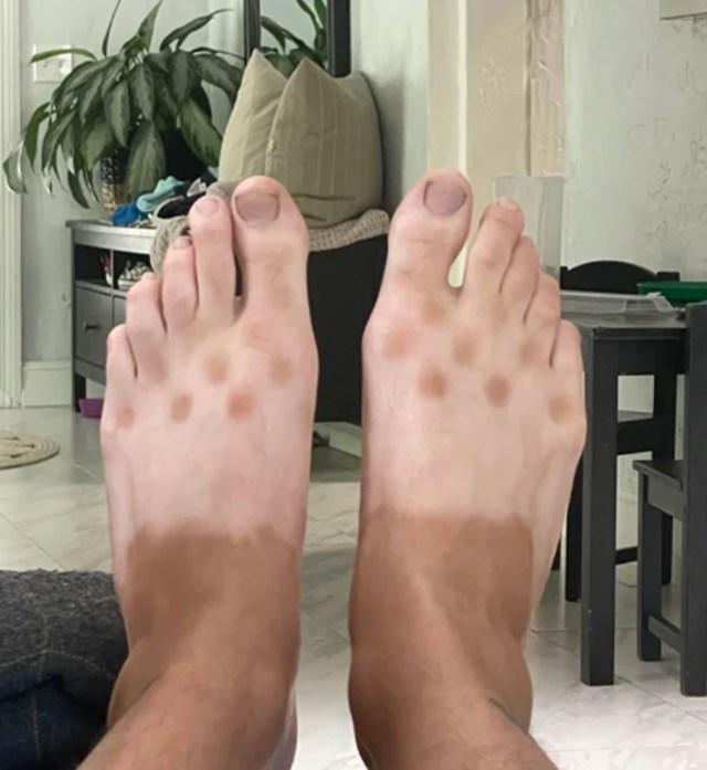 "Evo što se dogodi kad nosite Crocs natikače dok satima šetate gradom..."