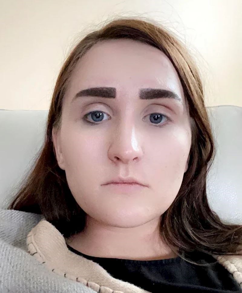 18. "Ove grozne obrve će mi ostaviti ožiljke za čitav život"