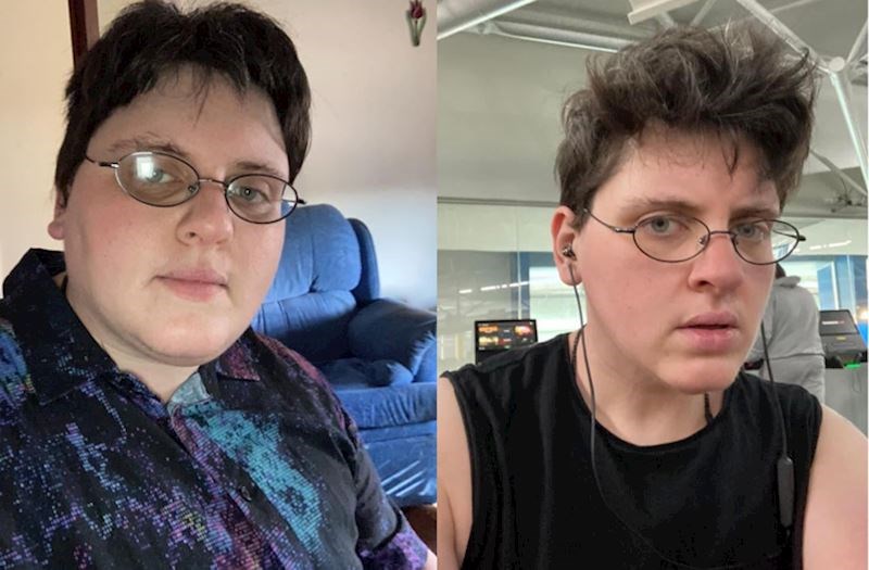 "14 mjeseci kasnije konačno imam neki oblik lica"