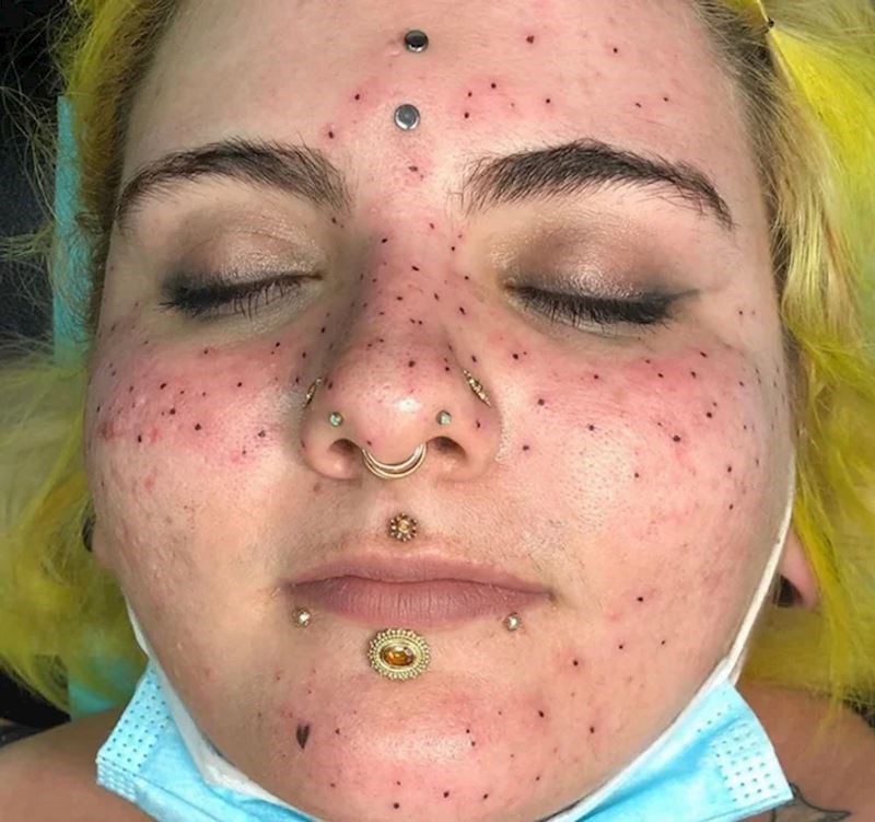 6. Baš nas zanima koliko je trebalo da požali što je tetovirala "pjegice"