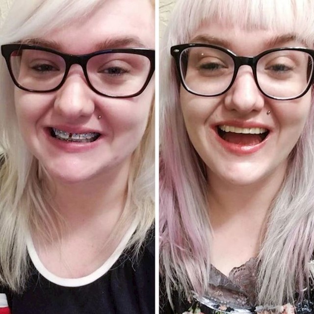 10.