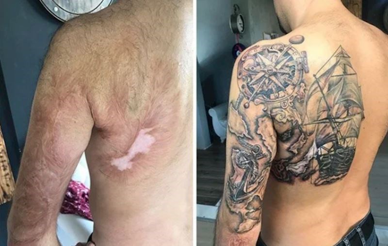 Prezadovoljan sam tetovažom. Prekrila mi je cijeli ožiljak!