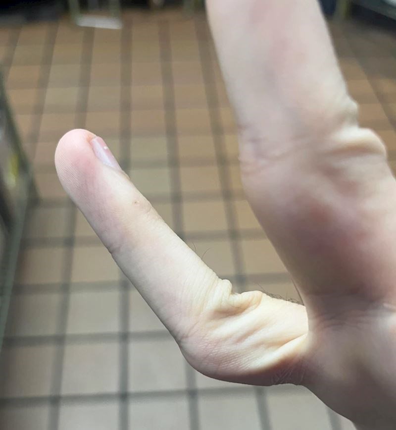 "Nedavno sam primijetio da mogu na jako čudan način saviti prst"