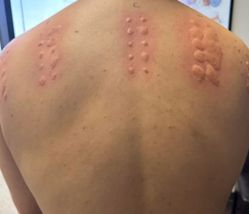 "Išao sam se testirati na alergije, ispada da sam na sve alergičan."