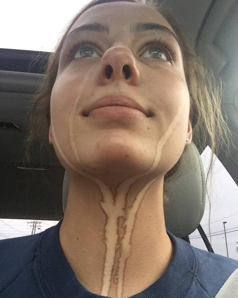 9. "Sprej za samotamnjenje mi je nadražio oči i sad izgledam ovako"