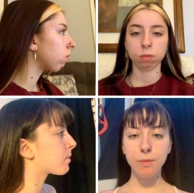 7.
