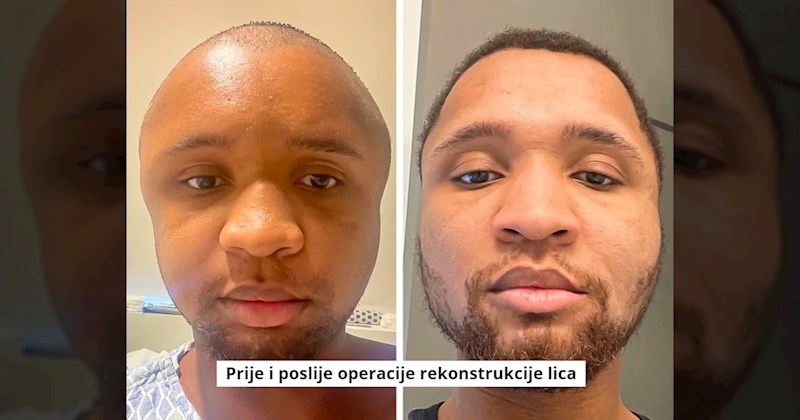 10+ drastičnih transformacija koje dokazuju da je baš sve moguće. Pogledajte što smo izdvojili