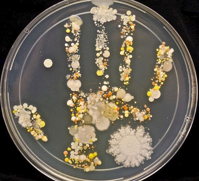Bakterije na ruci osmogodišnjeg djeteta nakon čitavog dana igre vani