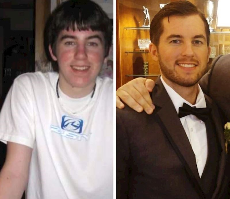 21. "Kako sam izgledao sa 17, a kako s 28 godina"