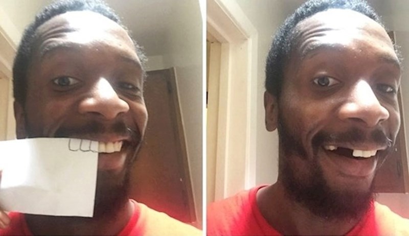 "Konačno sam popravio zube hahahah!"