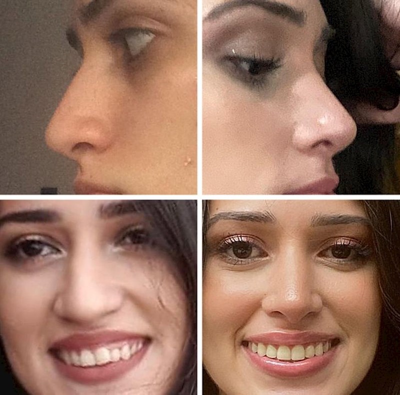 15. "Nisam vjerovala da ću nakon operacije izgledati toliko drugačije, a onda sam se pogledala u ogledalo..."