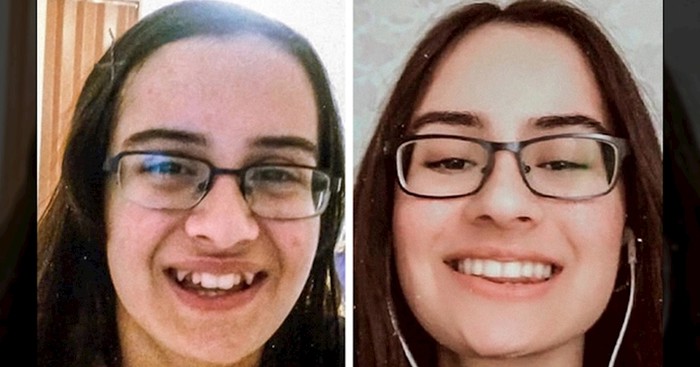 19 ljudi koji su se potpuno transformirali nakon što su popravili zube i sad se ne prestaju smijati