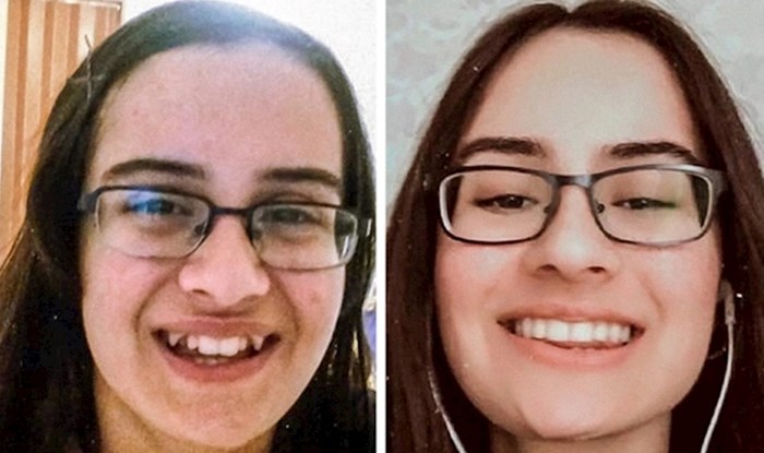 19 ljudi koji su se potpuno transformirali nakon što su popravili zube i sad se ne prestaju smijati