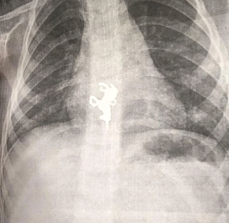 "Evo što se događa kad su sami i neobični tihi"