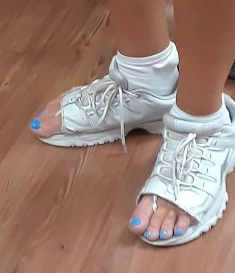 4. Ono kad je vruće, a ne želiš kupovati novu obuću