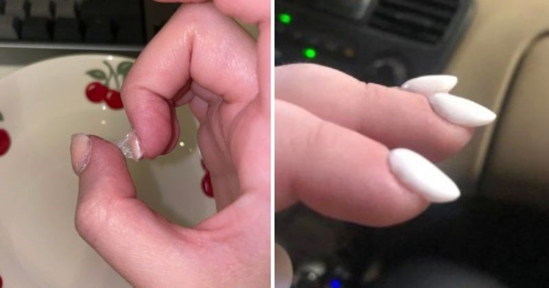 11 cura koje će još dugo pamtiti ove užasne manikure koje su napravili navodni profesionalci