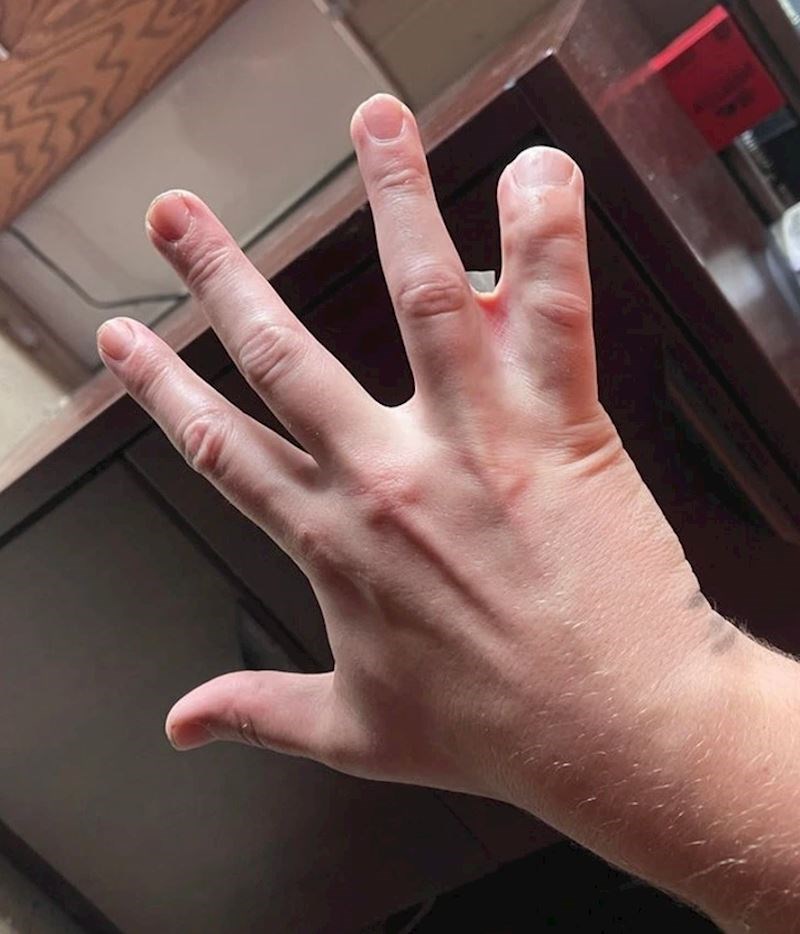 3. "Moj šef ima dva mala prsta i još su mu spojeni"