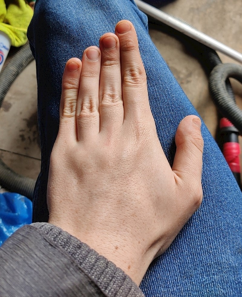 7. Malo drugačiji izgled prstiju na ruci