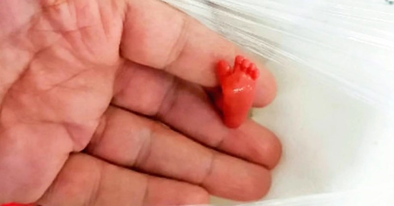 7. Fotografija stopala bebe koja se rodila 12 tjedana prije termina i uspjela preživjeti.