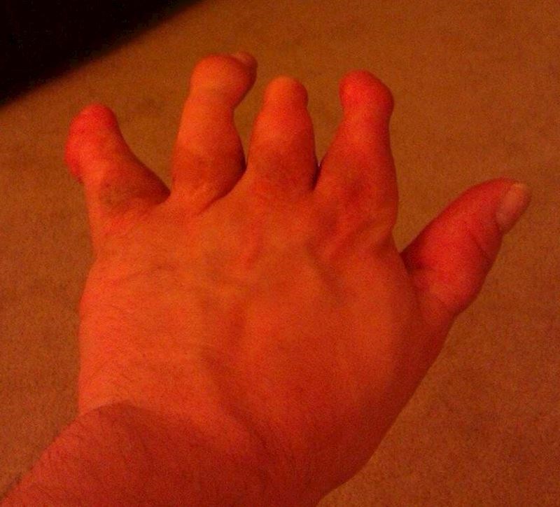 "Ovako izgleda moja lijeva ruka"