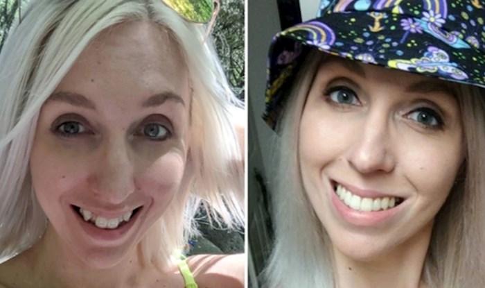 Ovim ljudima se život drastično promijenio nakon što su popravili zube, transformacije su predobre!