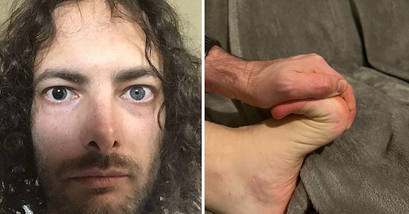 10 ljudi koji su rođeni da se ističu, pogledajte njihove jedinstvene fizičke karakteristike