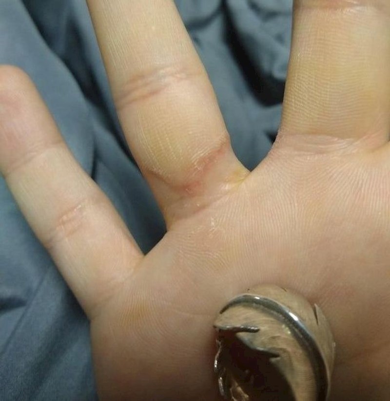 10. "Nisam mogao vjerovati kako mi izgleda prst nakon što sam godinama svaki dan i bez skidanja nosio prsten"