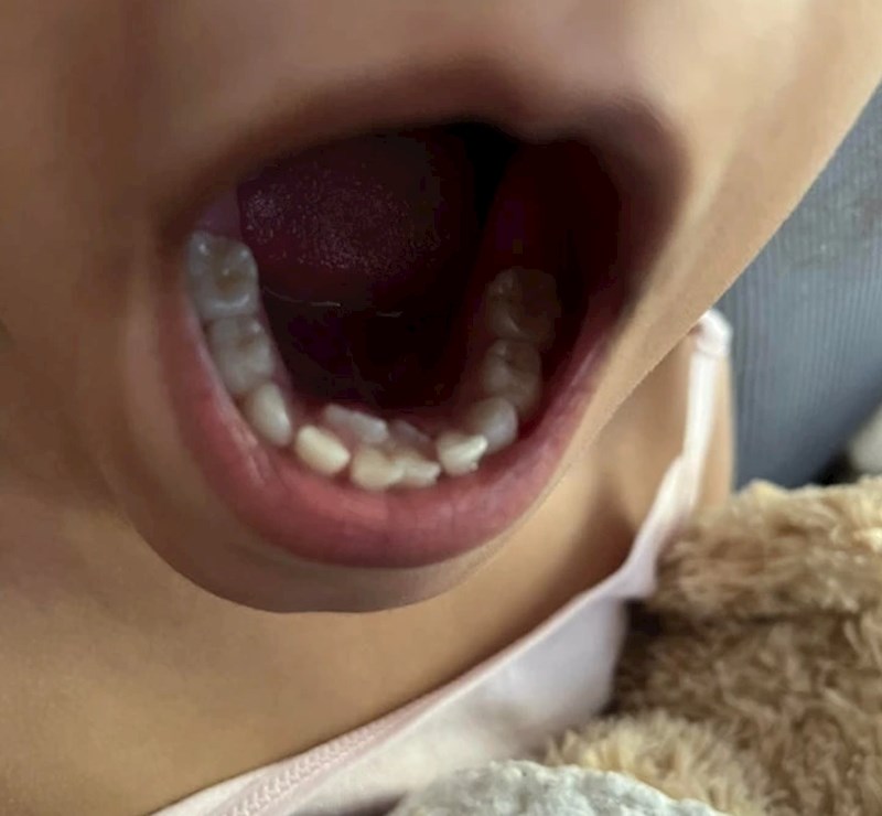 7. "Moja kćer ima nekoliko zubića viška"