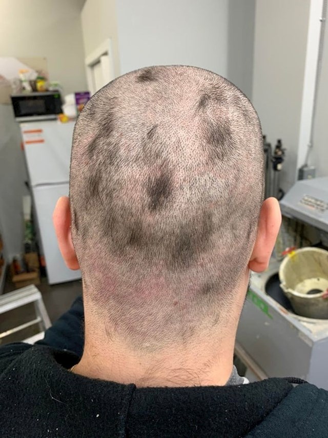 4. "Ovako sam izgledao nakon što sam se sam ošišao. Čak sam i danima išao ovako na posao, a onda me jedan kolega povukao sa strane i pitao jesam li dobro. Ošišao sam se i izgledao kao da mi otpada kosa"