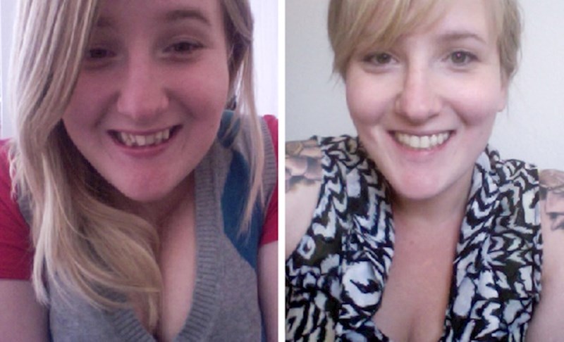 1. "Nakon godina i godina aparatića za zube, konačno imam osmijeh kakav sam oduvijek željela"