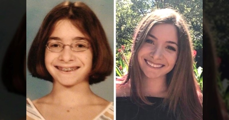 Ovi ljudi doživjeli su nevjerojatne transformacije s godinama, neki izgledaju neprepoznatljivo