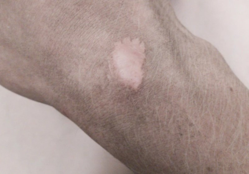 3. "Koliko god mi ruka bila prljava, ožiljak uvijek ostaje čist."