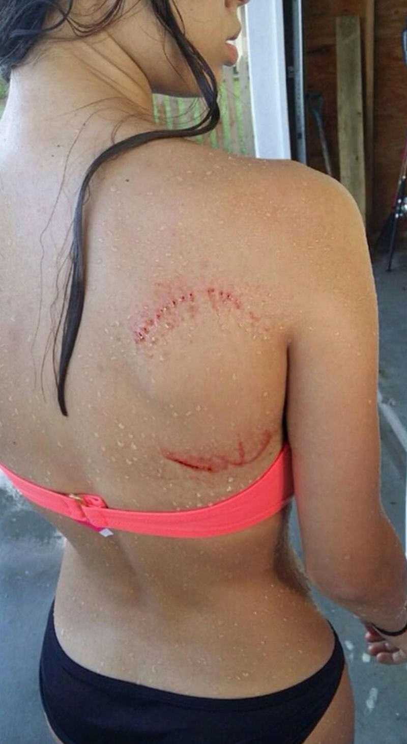 "Morski pas me gricnuo i samo pustio. Imala sam veliku sreću."