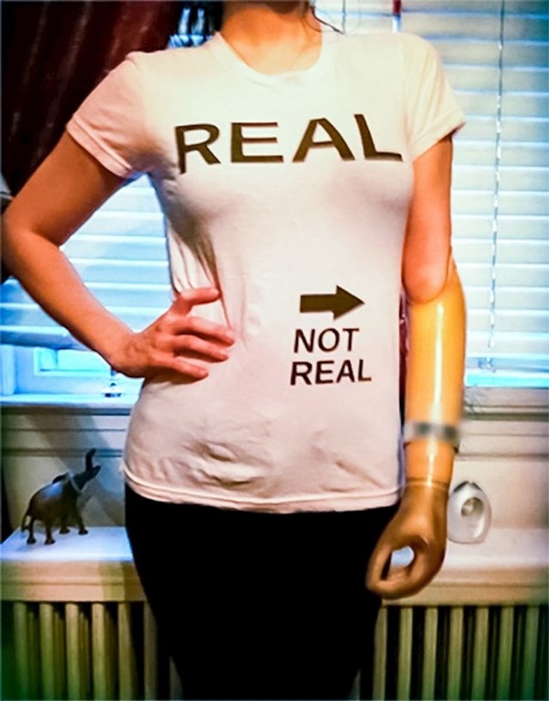 Da ne bi bilo zabune: grudi su prave, a ruka je umjetna