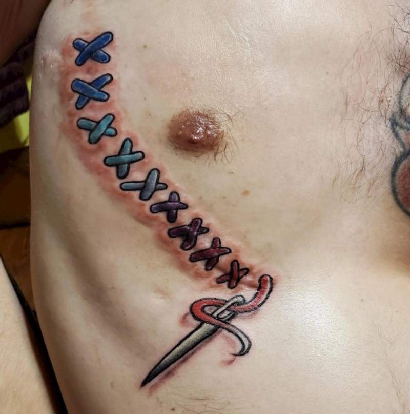 7. "Malo smo ukrasili ožiljak od operacije"