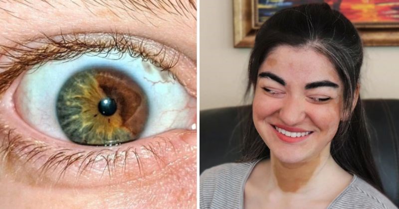 10+ pojedinaca koji su rođeni da se ističu u masi, pogledajte zbog čega su posebni