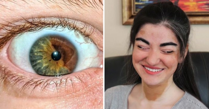 10+ pojedinaca koji su rođeni da se ističu u masi, pogledajte zbog čega su posebni
