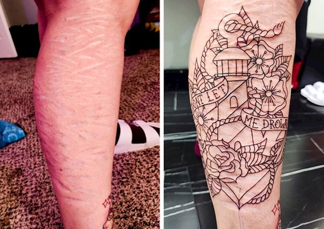 2. "Odlučio sam tetovažom prekriti ožiljak"