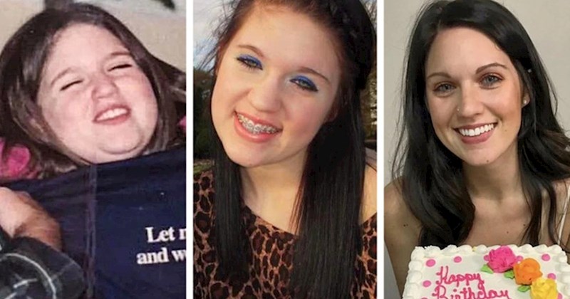 18 ljudi koji su s godinama doživjeli nevjerojatne fizičke promjene, transformacije su nevjerojatne