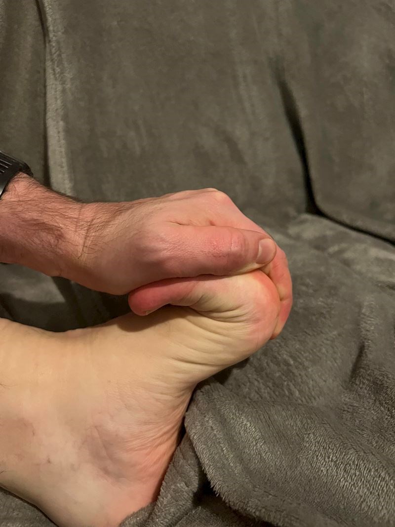 "Imam Ehlers–Danlosov sindrom koji zahvaća kožu, zglobove i stijenke krvnih žila. Zbog ovog sindroma mogu u potpunosti saviti prste na nogama i rukama"