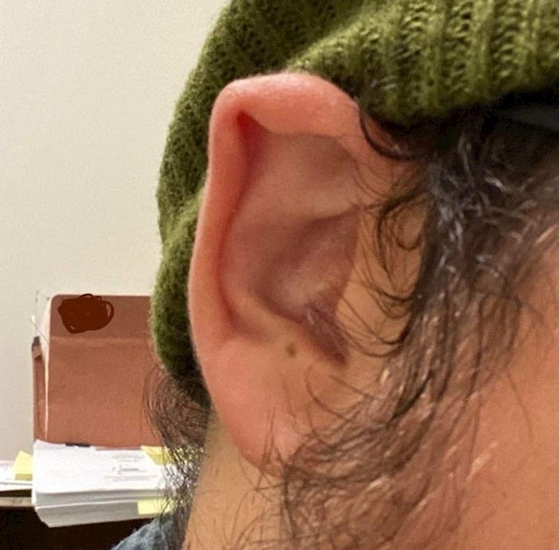 14. "Moje vilenjačko uho"